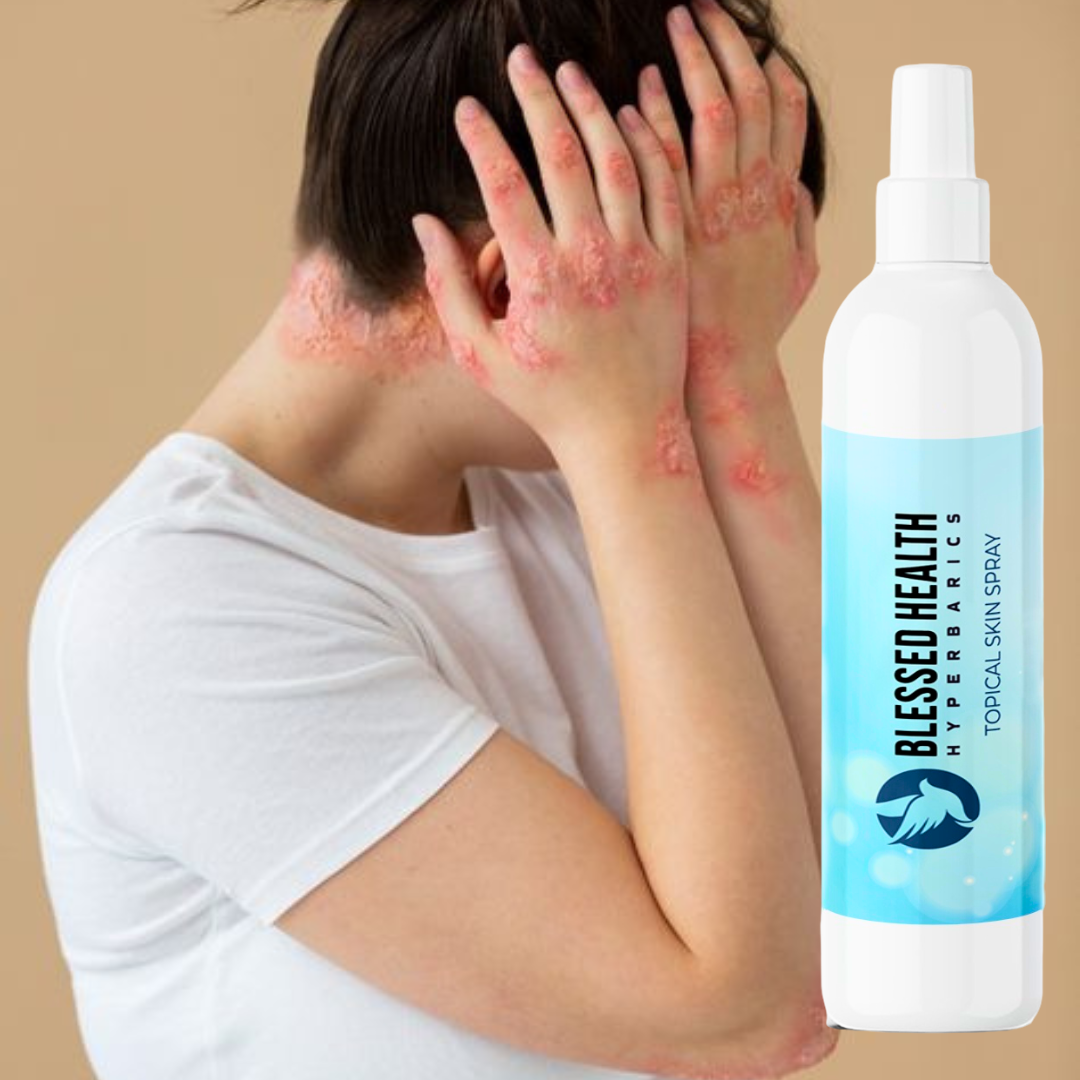 Blessed Health-Topical Skin Spray