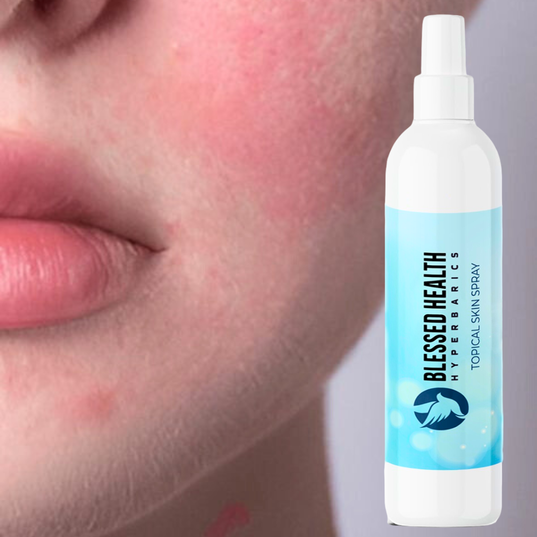Blessed Health-Topical Skin Spray