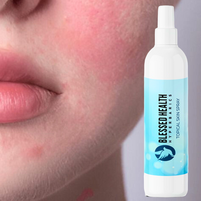 Blessed Health-Topical Skin Spray