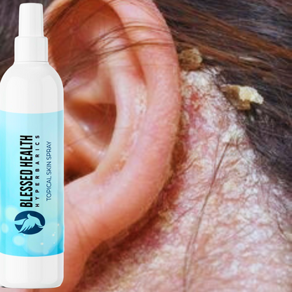 Blessed Health-Topical Skin Spray