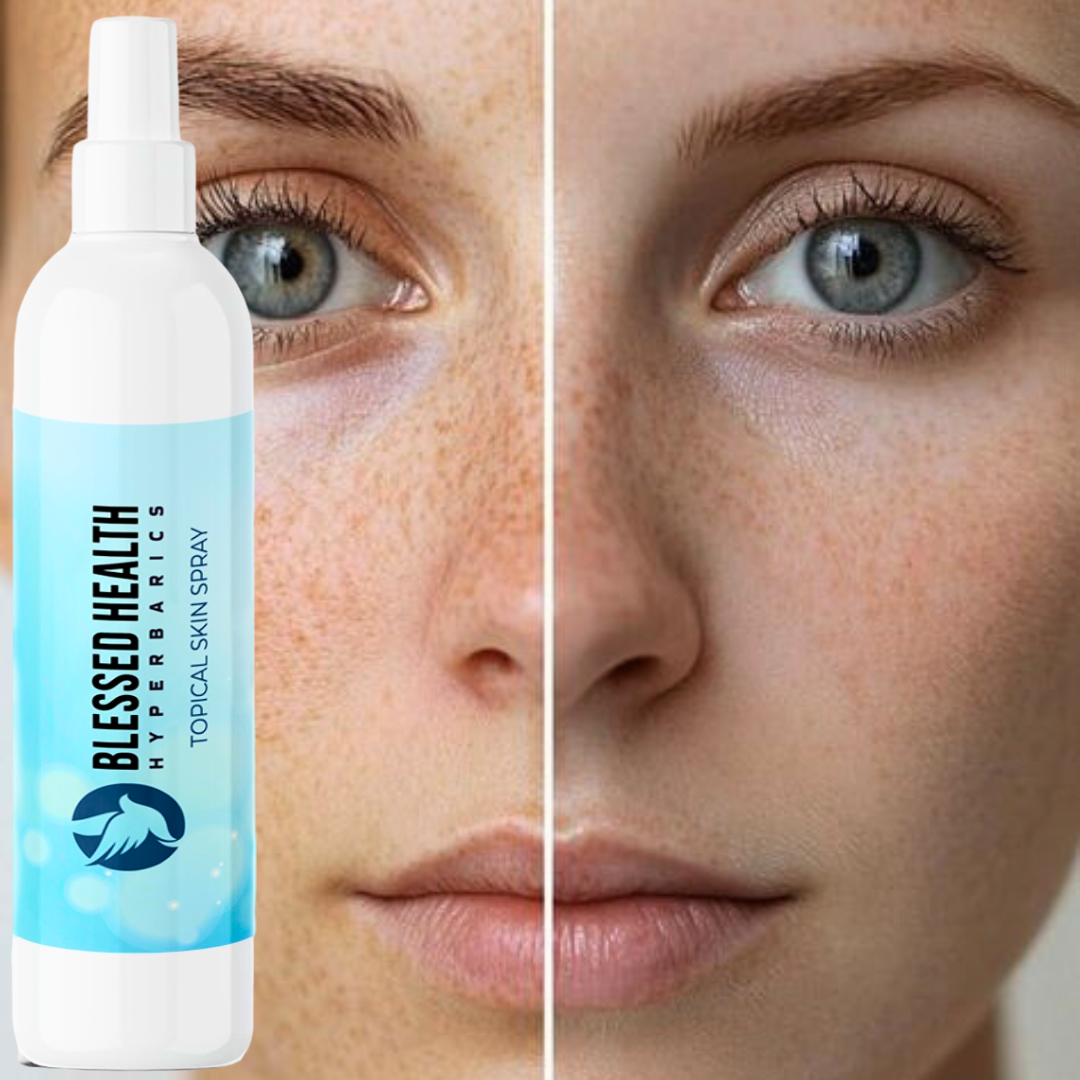Blessed Health-Topical Skin Spray