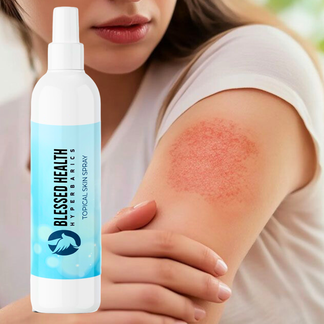 Blessed Health-Topical Skin Spray